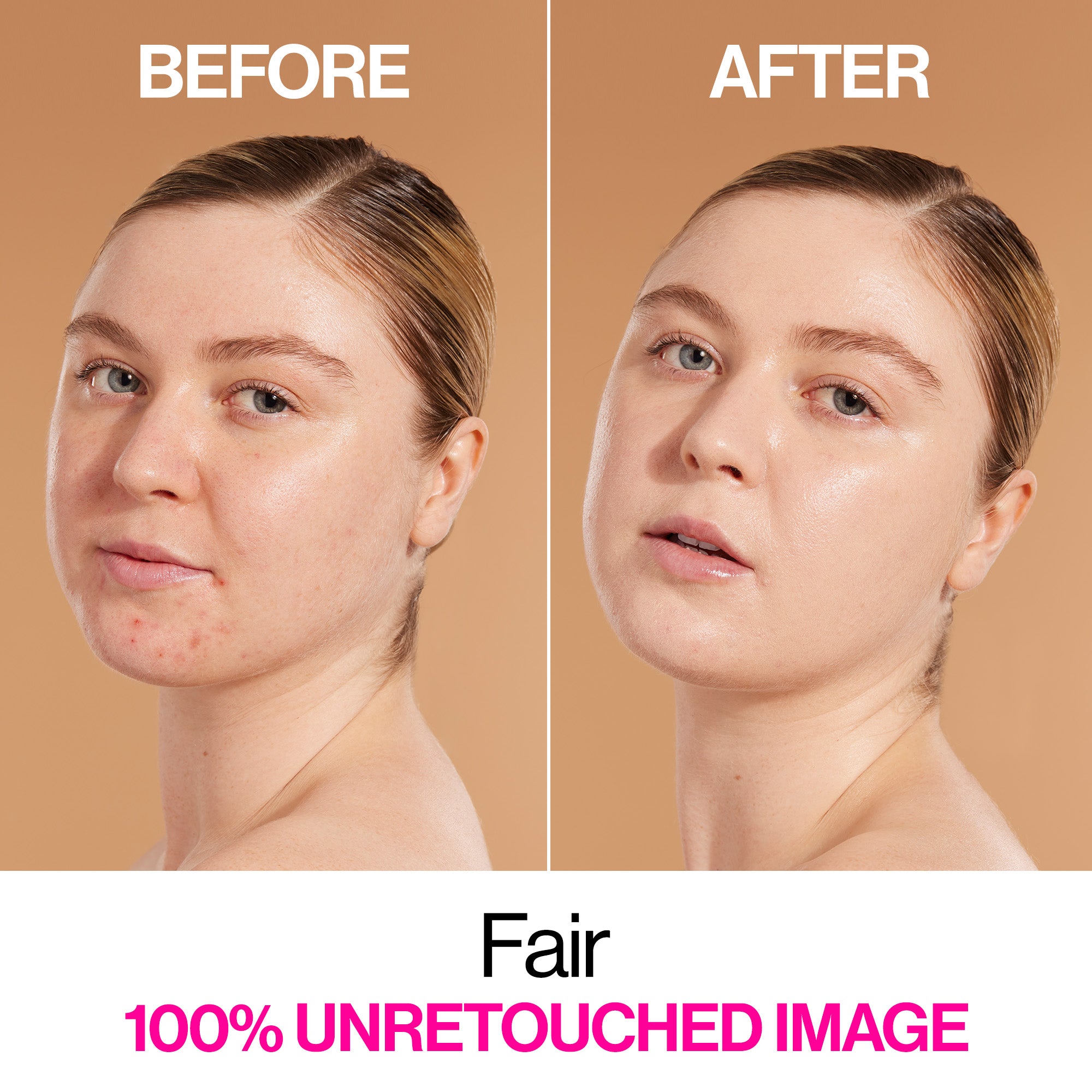 Bare Focus Niacinamide Skin Tint | Fair - wet n wild Beauty